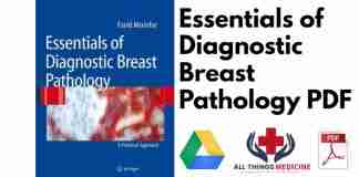Essentials of Diagnostic Breast Pathology PDF