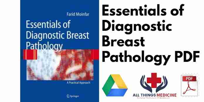 Essentials of Diagnostic Breast Pathology PDF