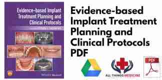 Evidence-based Implant Treatment Planning and Clinical Protocols PDF