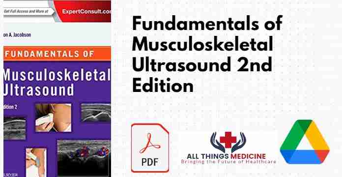 Fundamentals of Musculoskeletal Ultrasound 2nd Edition PDF