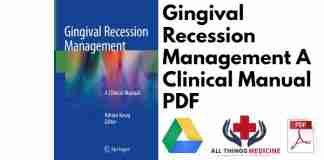 Gingival Recession Management A Clinical Manual PDF