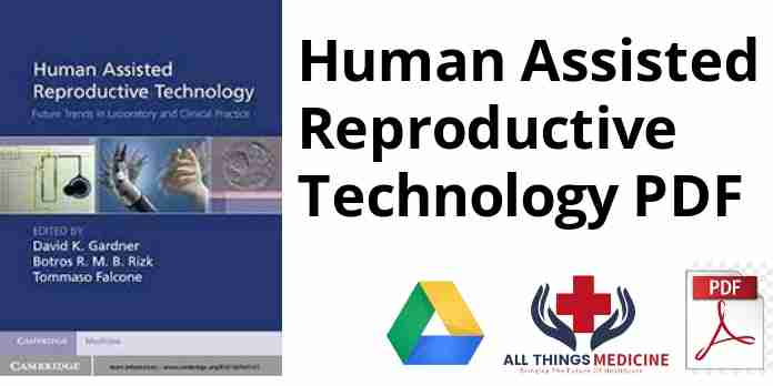Human Assisted Reproductive Technology PDF
