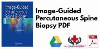 Image-Guided Percutaneous Spine Biopsy PDF
