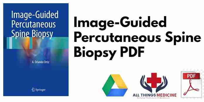 Image-Guided Percutaneous Spine Biopsy PDF