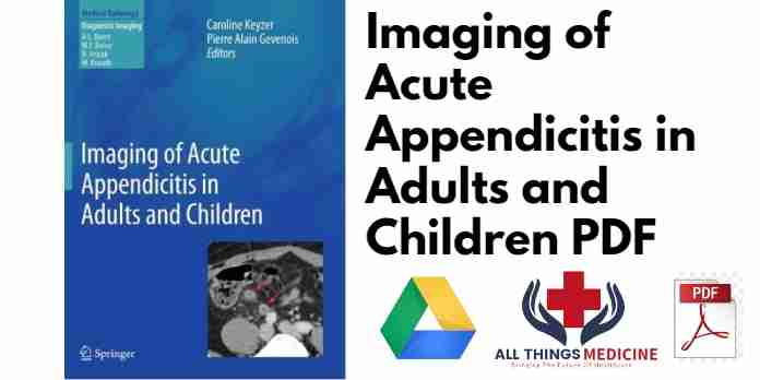 Imaging of Acute Appendicitis in Adults and Children PDF