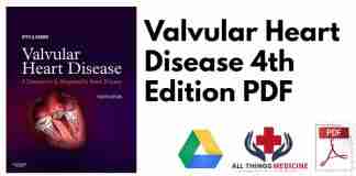 Valvular Heart Disease 4th Edition PDF