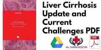 Liver Cirrhosis Update and Current Challenges PDF