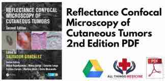 Reflectance Confocal Microscopy of Cutaneous Tumors 2nd Edition PDF