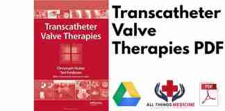 Transcatheter Valve Therapies PDF