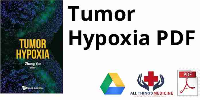 Tumor Hypoxia PDF