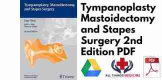 Tympanoplasty Mastoidectomy and Stapes Surgery 2nd Edition PDF