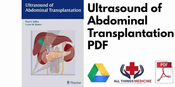Ultrasound of Abdominal Transplantation PDF