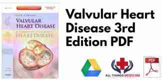 Valvular Heart Disease 3rd Edition PDF