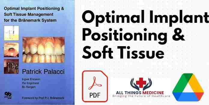 Optimal Implant Positioning & Soft Tissue PDF