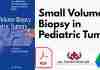 Small Volume Biopsy in Pediatric Tumors PDF