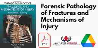 Forensic Pathology of Fractures and Mechanisms of Injury PDF