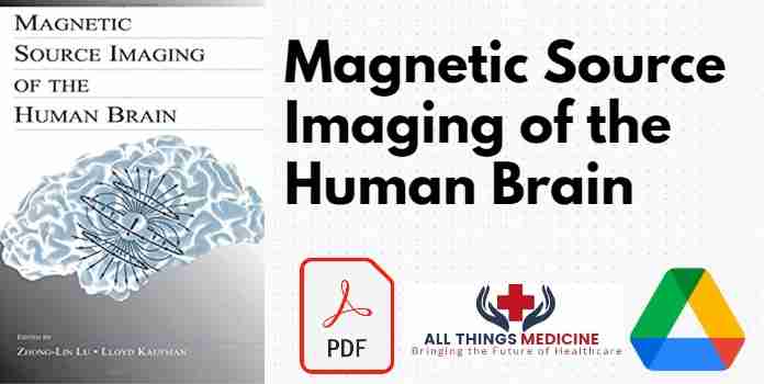Magnetic Source Imaging of the Human Brain PDF