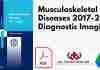 Musculoskeletal Diseases 2017-2020: Diagnostic Imaging PDF