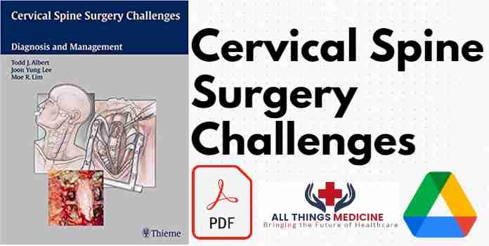 Cervical Spine Surgery Challenges PDF