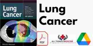 Lung Cancer PDF