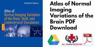 Atlas of Normal Imaging Variations of the Brain PDF