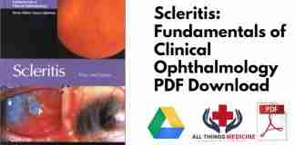Scleritis: Fundamentals of Clinical Ophthalmology PDF