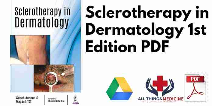 Sclerotherapy in Dermatology 1st Edition PDF