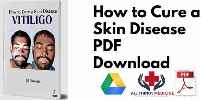 How to Cure a Skin Disease PDF