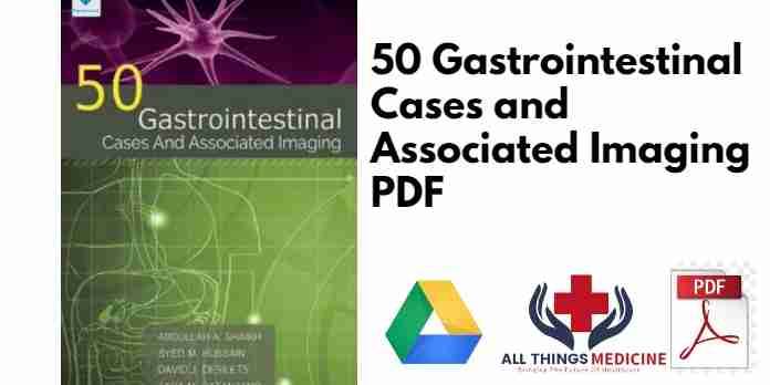 50 Gastrointestinal Cases and Associated Imaging PDF