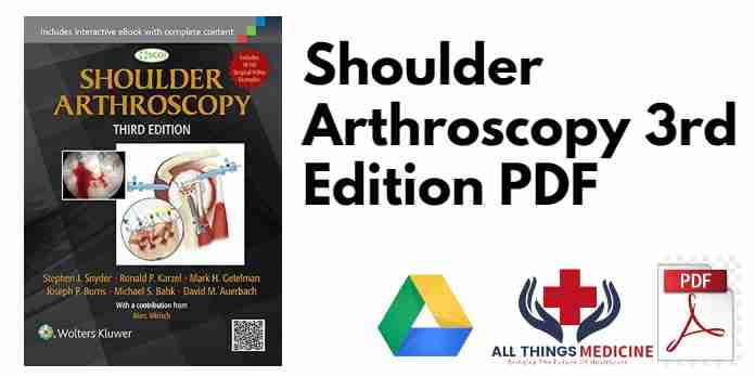 Shoulder Arthroscopy 3rd Edition PDF