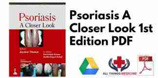 Psoriasis A Closer Look 1st Edition PDF