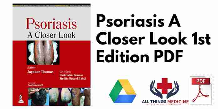 Psoriasis A Closer Look 1st Edition PDF