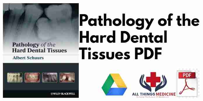 Pathology of the Hard Dental Tissues PDF