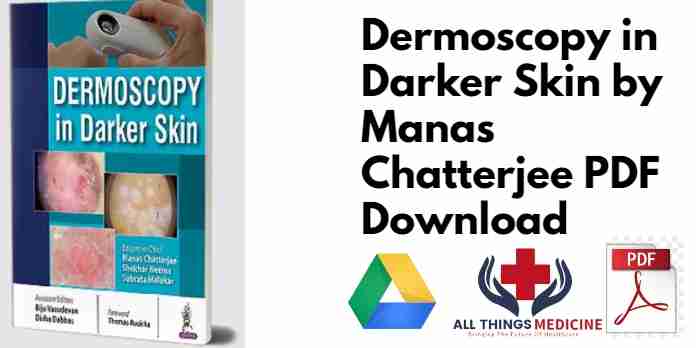 Dermoscopy in Darker Skin by Manas Chatterjee PDF