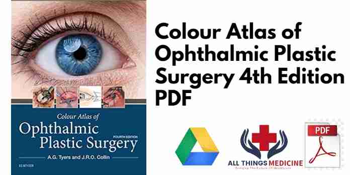 Colour Atlas of Ophthalmic Plastic Surgery 4th Edition PDF