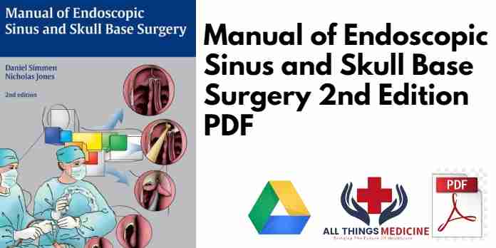 Manual of Endoscopic Sinus and Skull Base Surgery 2nd Edition PDF