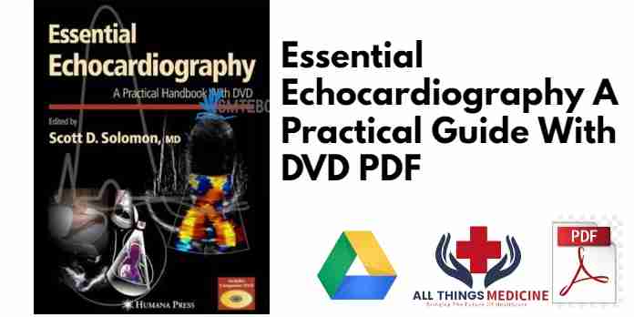Essential Echocardiography A Practical Guide With DVD PDF