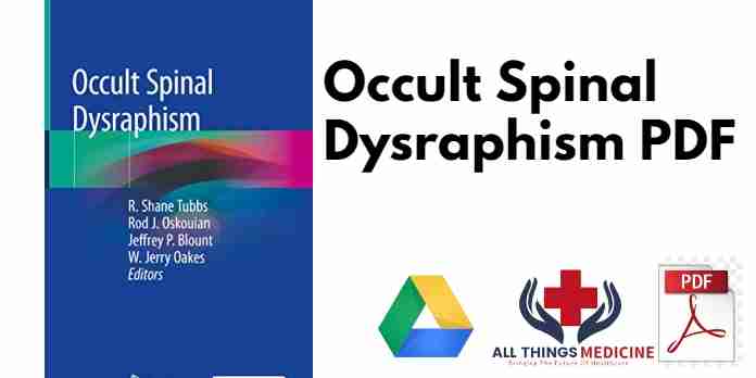 [BeFunky patch_jqeepkimzh] Occult Spinal Dysraphism PDF