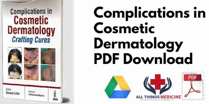 Complications in Cosmetic Dermatology PDF