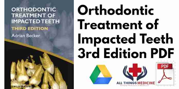 Orthodontic Treatment of Impacted Teeth 3rd Edition PDF