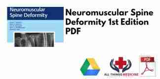 Neuromuscular Spine Deformity 1st Edition PDF