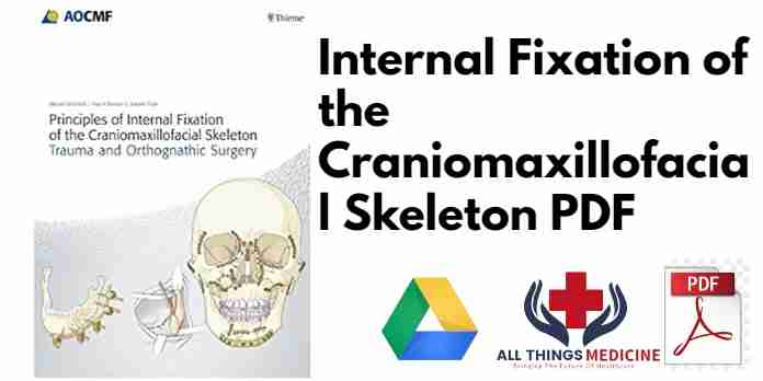 Internal Fixation of the Craniomaxillofacial Skeleton PDF