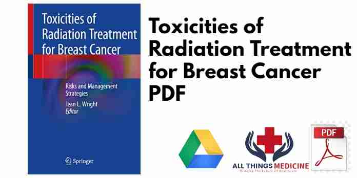 Toxicities of Radiation Treatment for Breast Cancer PDF