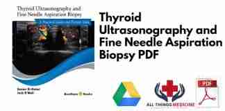 Thyroid Ultrasonography and Fine Needle Aspiration Biopsy PDF