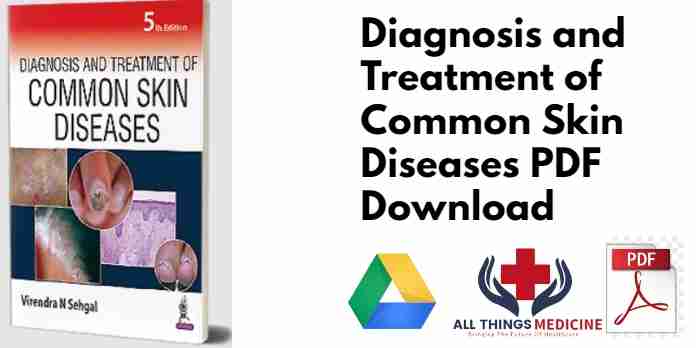 Diagnosis and Treatment of Common Skin Diseases PDF