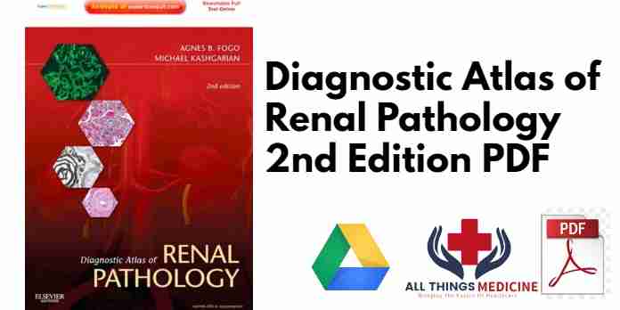 Diagnostic Atlas of Renal Pathology 2nd Edition PDF