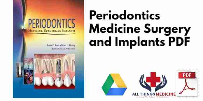 Periodontics Medicine Surgery and Implants PDF