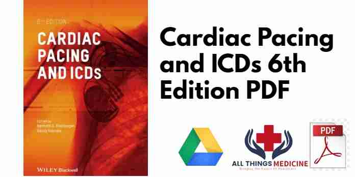 Cardiac Pacing and ICDs 6th Edition PDF