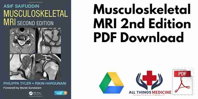 Musculoskeletal MRI 2nd Edition PDF