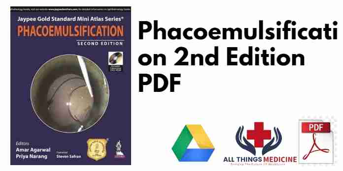 Phacoemulsification 2nd Edition PDF